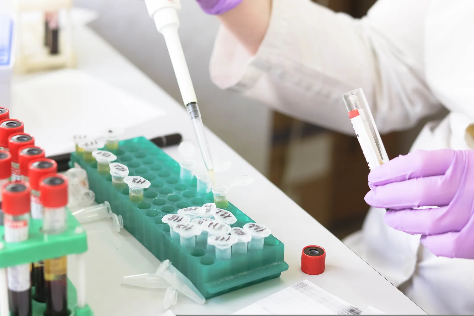 Gloved hands using a pipette and test tube beside racks of laboratory samples