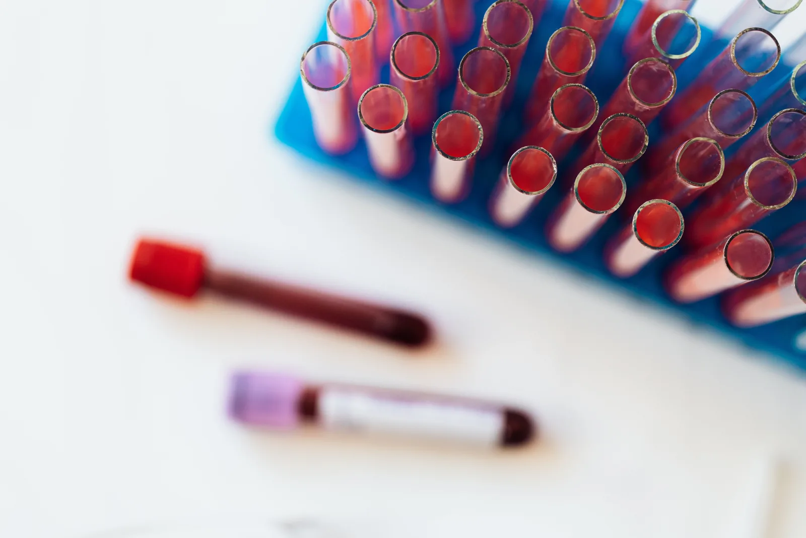 Rack of blood sample tubes with two tubes lying on the table